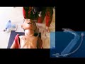Intubation Intubation