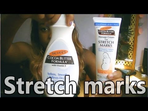 how to use vitamin e oil for stretch marks