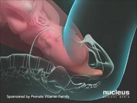 how to care episiotomy wound