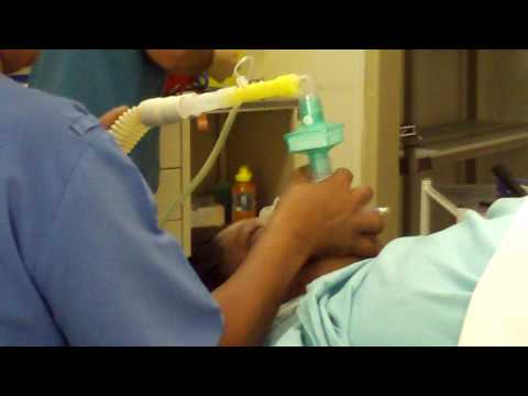 how to administer general anesthesia