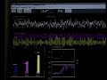 9 - EEG Training