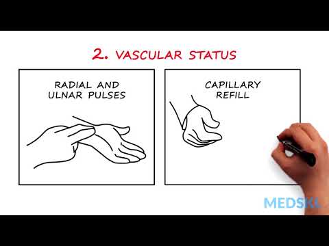 video-linktoworks-Hand and/or Wrist Injuries: How to easily test nerve...