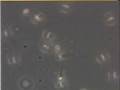 Spermatozoa