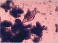 Rotifer feeding - Rotifero alimentandose