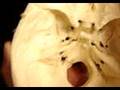 sphenoid bone