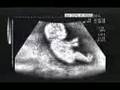 videos de Feto conductor