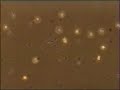 Trypanosoma lewisi trypomastigotes Blood Smear
