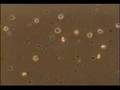 Trypanosoma lewisi trypomastigotes