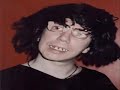 charlie-zelenoff-has-learning-disabilities.html