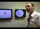 Coronary Interventional Radiology Coronary Interventional Radiology