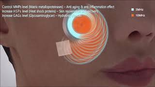 video thumbnail CELLEON (Ultrasonic Massager for Skin Care) youtube