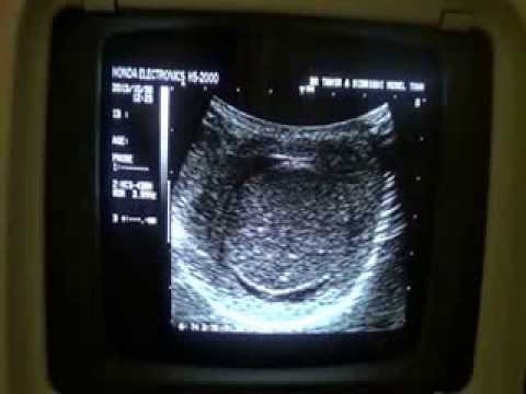 how to cure orchitis