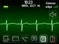 Electrocardiogram