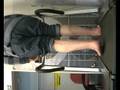 Valgus Forefoot