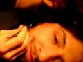 Botfly Removal from Nate's Face