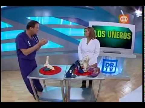 El tratamiento de las uñas contra la exfoliación y las grietas
