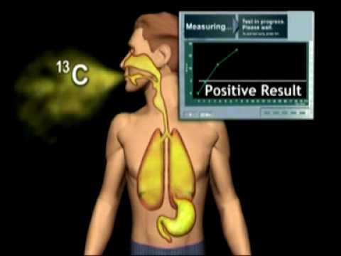 how to perform urea breath test