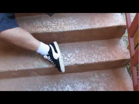 how to cure twisted foot