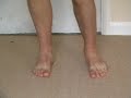 ANKLE THERAPY