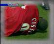 Cisse Breaks Leg