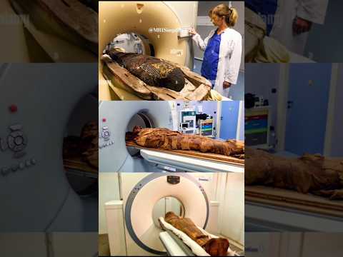 2000-year-old secret revealed 🤔#mriscan #MRIshorts #medicalshorts #mri #sciencemagics