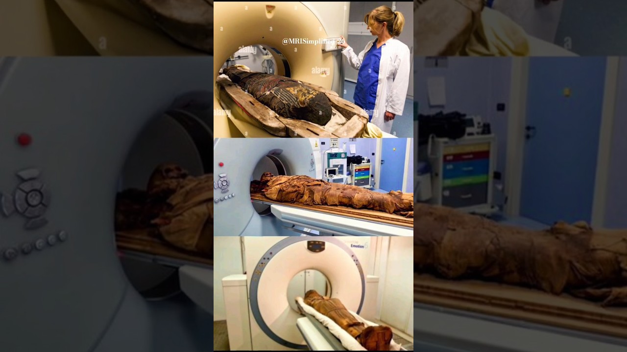 2000-year-old secret revealed 🤔#mriscan #MRIshorts #medicalshorts #mri #sciencemagics