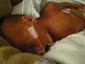 rocky, nasal canula, warm bed