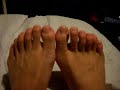 Rathy 12 toes