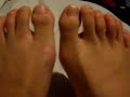 Rathy 12 toes