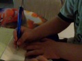 Down syndrome:&nbsp;S�ndrome de Down: DIFhabilidad