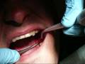 Pull My Rotten Tooth NOW!!!