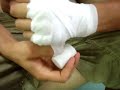 self bandage by profighter crazy884 self bandage by profighter crazy884