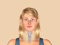 Medical animation of woman swallowing a pill Medical animation of woman swallowing a pill