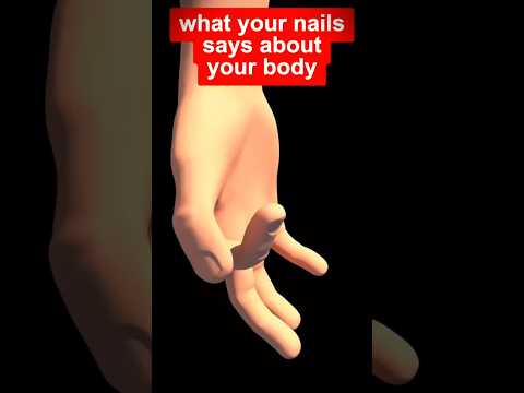 What Are Your Nails Telling You About Health? #facts #easynutrition #foodfacts #fruit #science