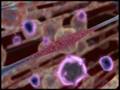 videos de MULTIPLE SCLEROSIS