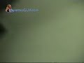 Tourettes guy - Montage
