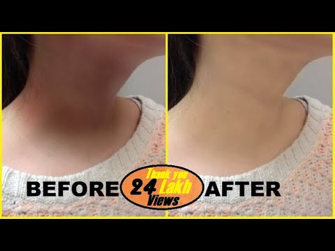 how to whiten neck