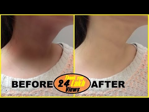 how to whiten dark neck