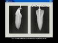 root-measure-unmount-maxillary.flv