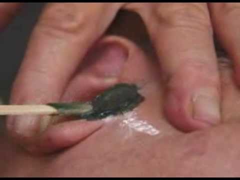 how to eliminate ear hair
