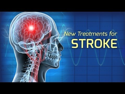 how to cure mild stroke