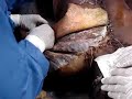 Diseccion hombro CUCS Diseccion hombro CUCS