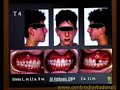 4 - Obiettivi di un trattamento tra i 7 e i 10 anni - (2/3)