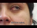 New Bedford Detainee Testimony