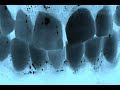 Asepsia/desepsia