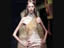 Anorexicas: El mundo de las momias andantes Anorexicas: El mundo de las momias andantes