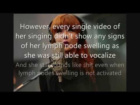 Park Bom (2NE1) - Worst Vocalist in Kpop