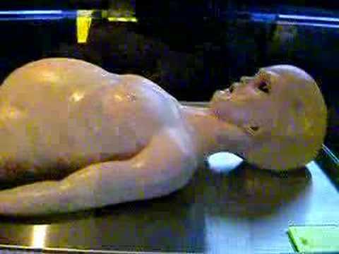 異質の検死