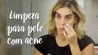 Fica a Dica – Passo a passo da limpeza para pele com acne