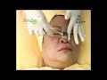 Skinzon CTS Roller Treatment
